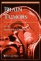 Brain Tumors (Contemporary Cancer Research)