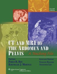 CT and MRI of the Abdomen and Pelvis: A Teaching File (LWW Teaching File Series), 2e