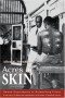 Acres of Skin: Human Experiments at Holmesburg Prison