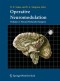 Operative Neuromodulation: Volume 2: Neural Networks Surgery (Acta Neurochirurgica Supplement)